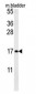 CCL4 Antibody (Center)